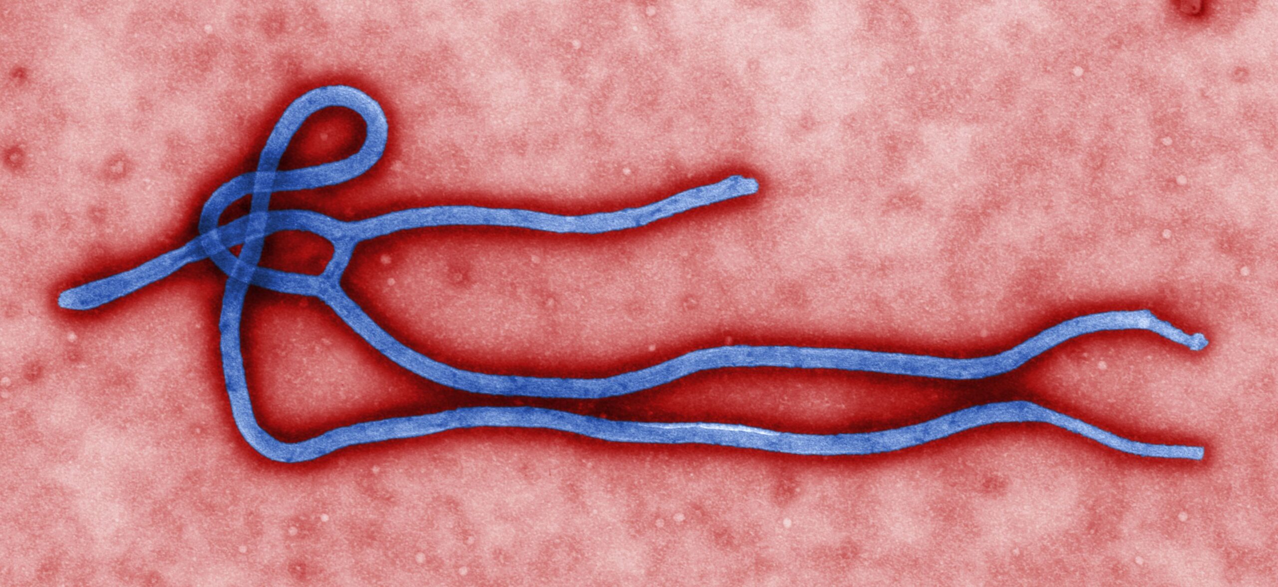 Ataque mata enfermeiro e ameaça resposta ao ebola na República Democrática do Congo